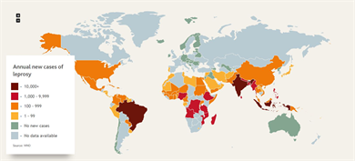 Where is leprosy found today?